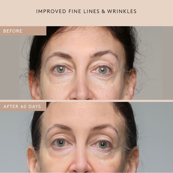 ๐2/$28 or 3/$38๐ Shani Darden Retinol Reform - Picture 5 of 8